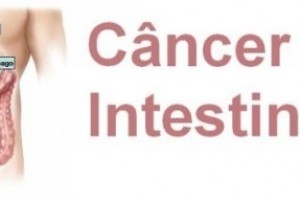 Vida e Saúde: Câncer colorretal pode ser prevenido e tem alta chance de cura