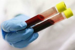 Amostras de sangue também podem ajudar avaliar alterações de um câncer