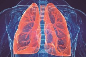 Hipertensão pulmonar: sintomas, tratamentos e causas