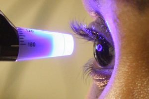Diagnóstico precoce pode evitar cegueira pelo glaucoma