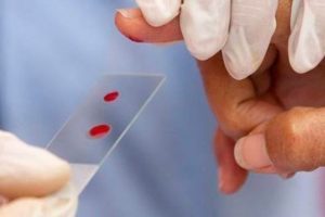 Anvisa aprova novo tratamento para hemofilia B