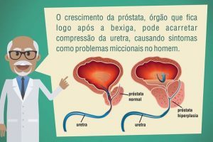 Um em cada seis homens tem câncer de próstata no Brasil, alerta Inca