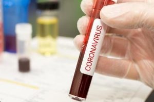 Covid-19: Manhuaçu tem 58 casos confirmados; mais uma morte na região