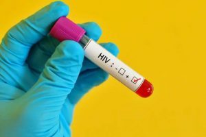 4º caso de cura do HIV no mundo recebeu transplante de medula