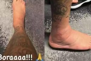 Veja como está o pé contundido de Neymar