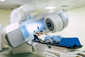 Mais de 70 mil pessoas não têm acesso a radioterapia por ano no Brasil